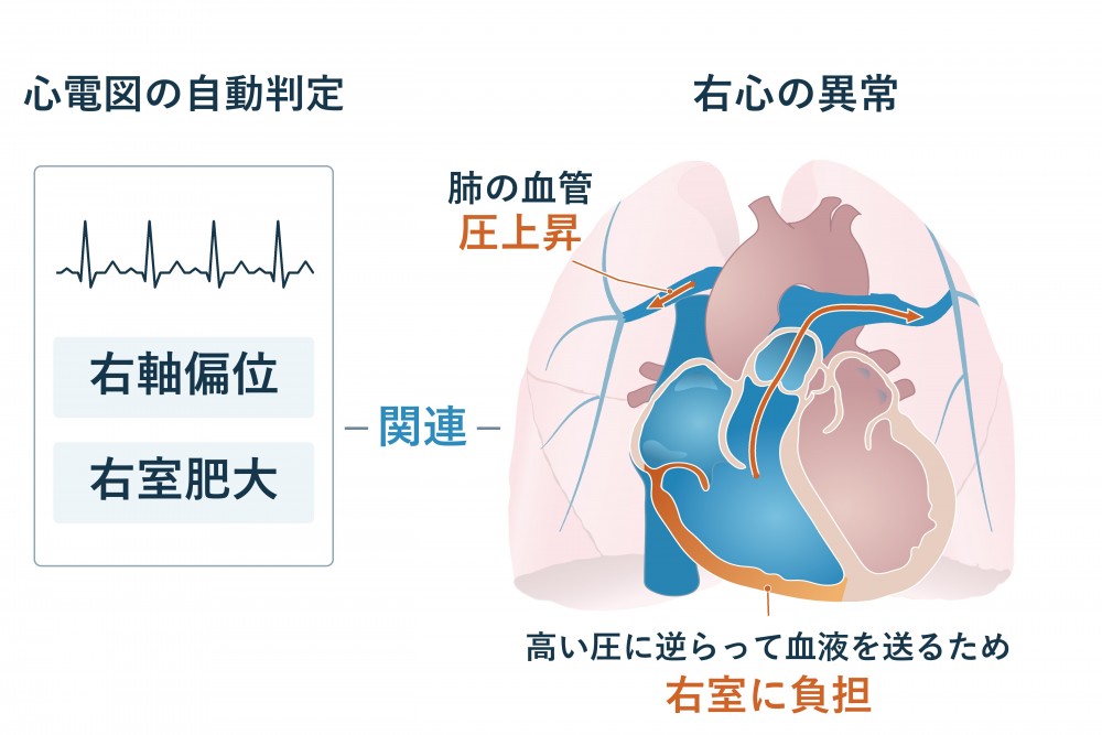 心臓の図１