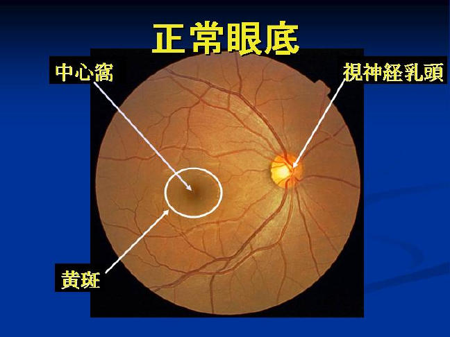 拡大写真１